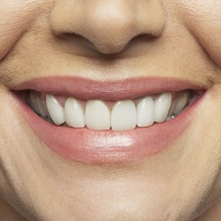 Closeup of flawless smile after all-ceramic restoration