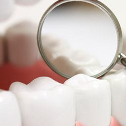 Enlarged teeth in dental mirror after sealant treatment