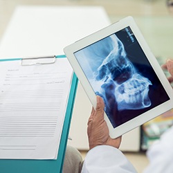 Dentist examining x-ray on tablet